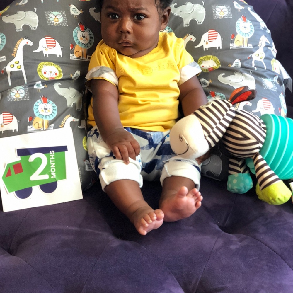 Burberry yellow t shirt worn once! 3-6 month